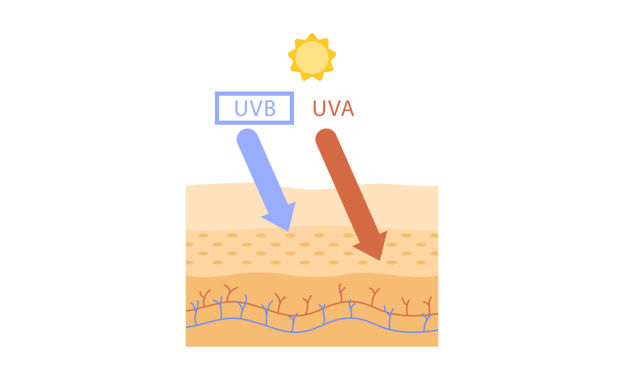 肌に炎症を引き起こすのはUV-B